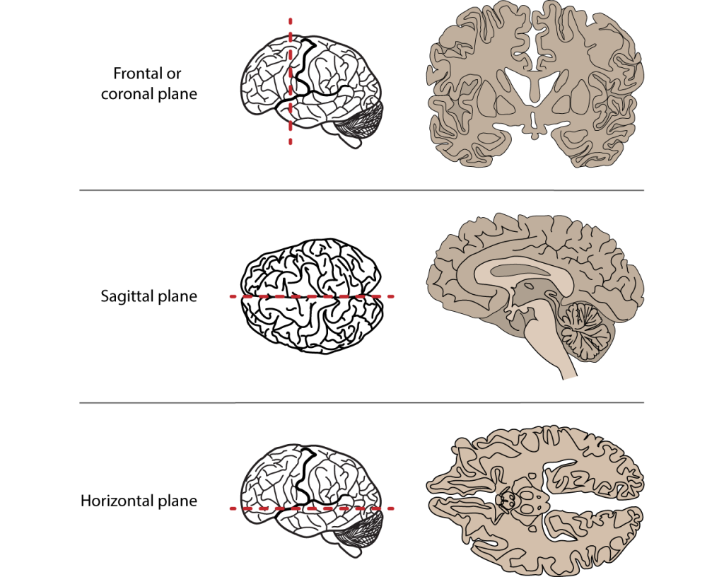 Anatomical planes
