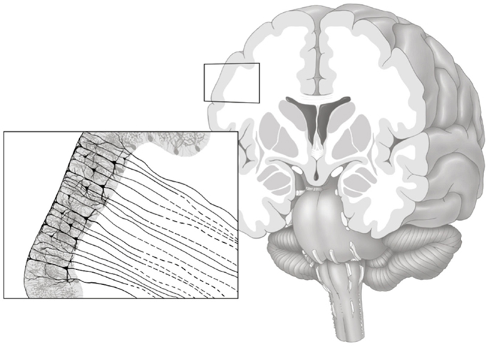 Gray-white matter
